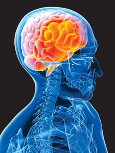 brainscan