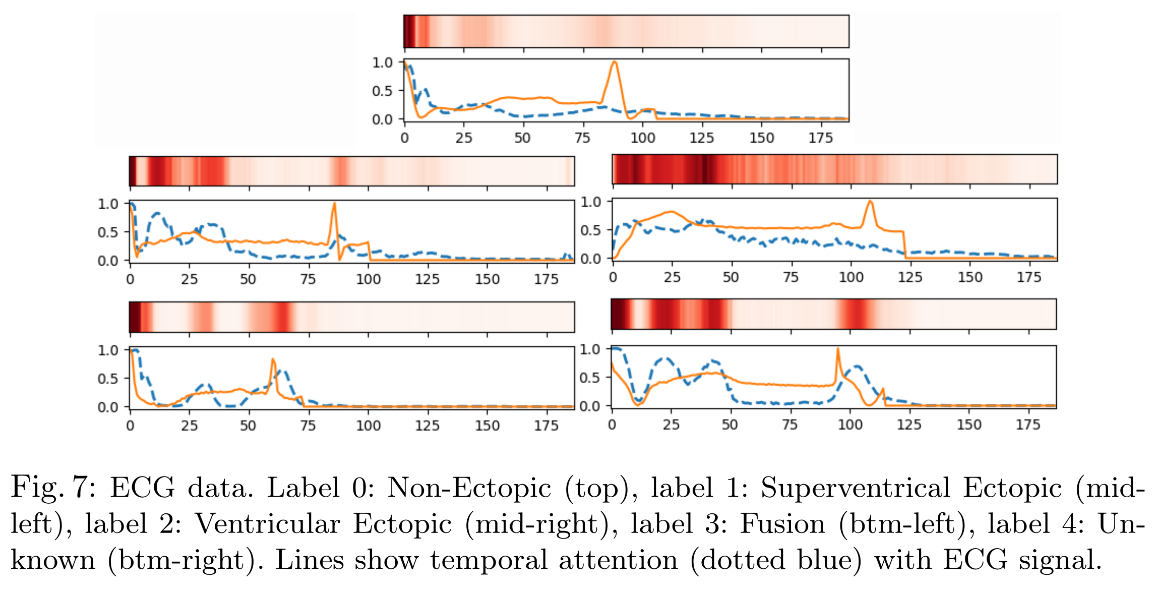 Temporal Attention Signatures